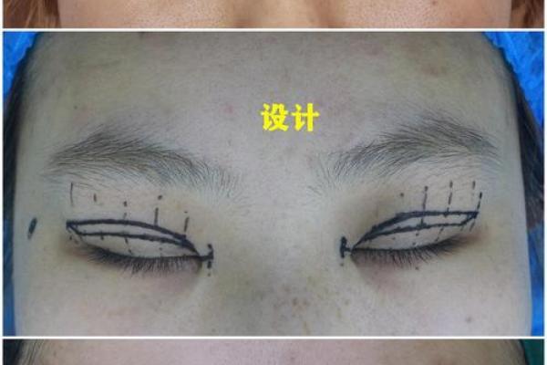 割双眼皮忌讳什么风水