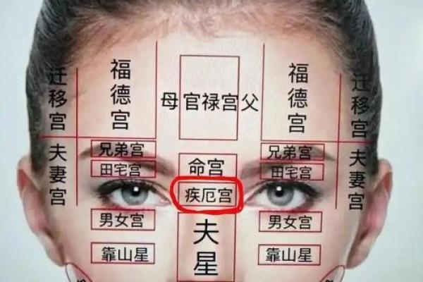紫薇斗数中疾