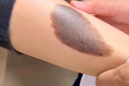 腿上不同位置的胎记算命