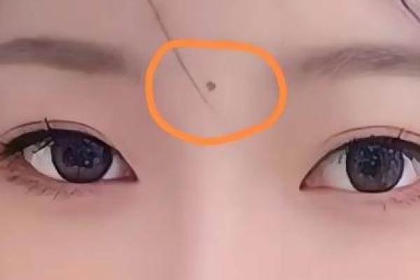 男人观音痣意味着什么 观音痣长在哪里
