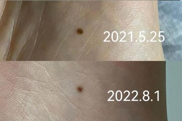 算命看脚相,脚心窝深的命运脚相