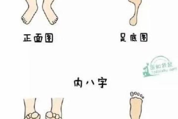 如何矫正外八字