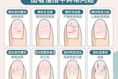 指甲 风水