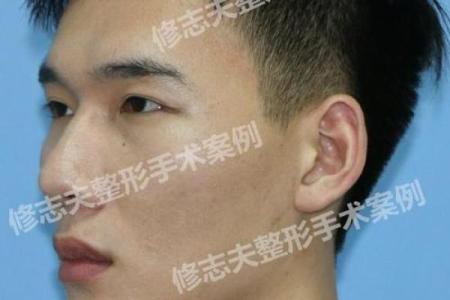男人胸口长毛算命