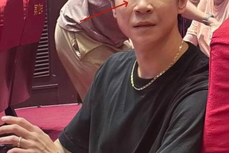 印堂八字纹的男人面相婚姻