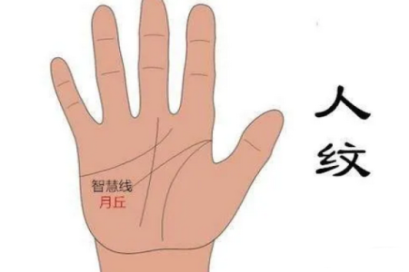 详解胎记算命